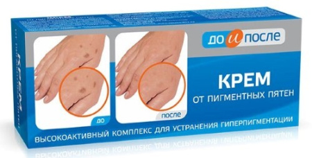 Крем До и после от пигментных пятен 50 мл